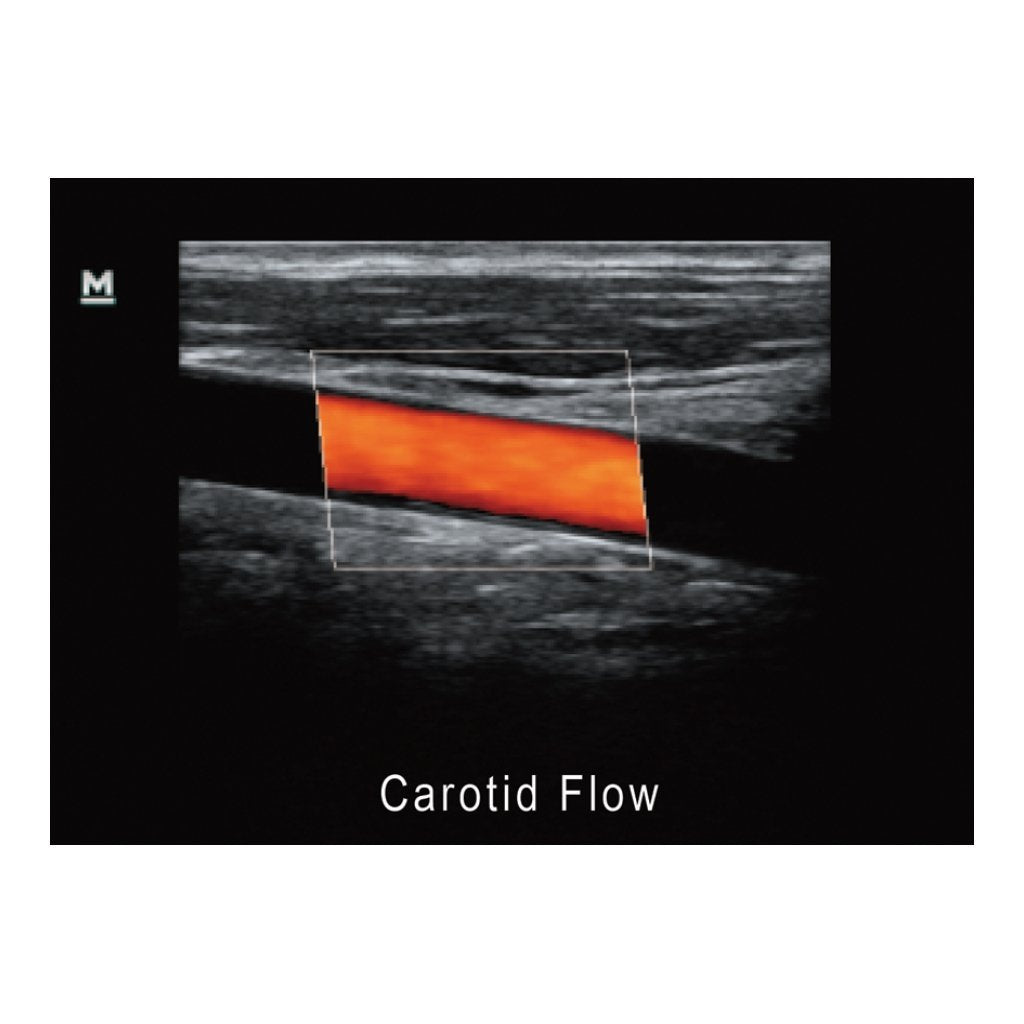 Color Doppler Mindray Z5 - 1 Pz.