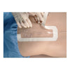 Tegaderm 3M - 10 X 25 cm - Sterile - Conf. 20 Pz.